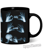 Load image into Gallery viewer, X-Ray Coffee Mug